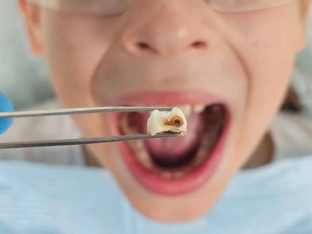 Best Emergency Dentist for Knocked-Out Tooth in Alamo, GA